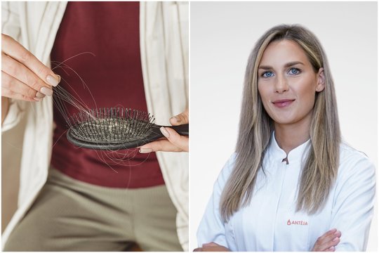Slenka plaukai? Gydytoja patarė, kaip sužinoti tikrąją priežastį