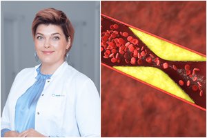 Išmokite kaip maldą: cholesteroliui suvaldyti – gydytojos receptas