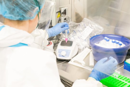 Įtemptos dienos: iš laboratorijos Vokietijoje laukiama lemiamų atsakymų dėl itin pavojingos ligos