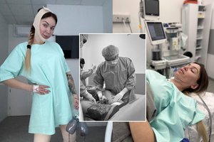 Justina Partikė ryžosi dar vienai plastinei operacijai