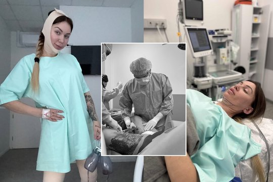 Justina Partikė ryžosi dar vienai plastinei operacijai