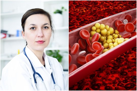 Kardiologai kelia raudoną vėliavą dėl cholesterolio: Lietuva – paskutinėje vietoje