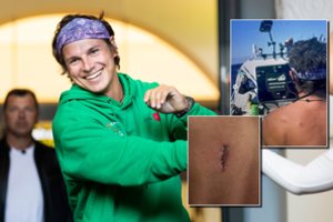 Aurimas Valujavičius gulėsi ant operacinio stalo: „Turiu pjūvį“