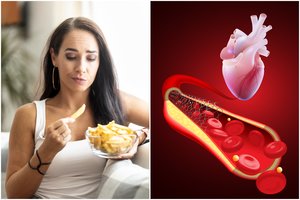 Turite padidėjusį cholesterolį? Štai ko negalima daryti po 17 valandos