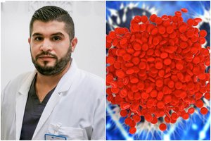 Gydytojas: trombozė gali baigtis mirtimi – kokie pirmieji šios ligos požymiai