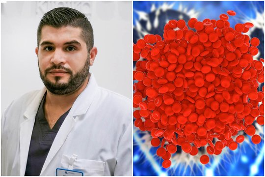 Gydytojas: trombozė gali baigtis mirtimi – kokie pirmieji šios ligos požymiai