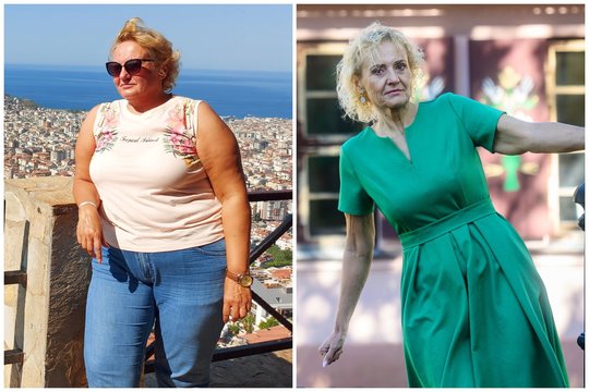 Klaipėdietė per metus atsikratė 60 kg: suplojo krūvą pinigų, bet apstulbę net kolegos