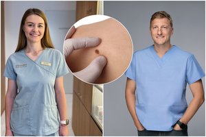 Gydytojai ragina suklusti: daugėja klastingo vėžio atvejų, liga greitai išplinta į kitus organus