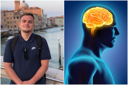 Veido tirpimas Edvinui išdavė klastingą smegenų ligą: atrodė, kad griūva pasaulis