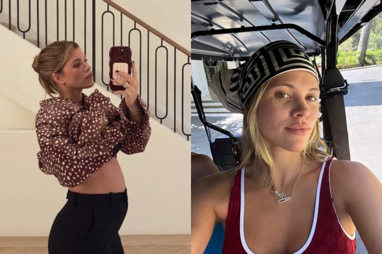 Sofia Richie pranešė džiugią žinią: laukiasi antrojo vaiko