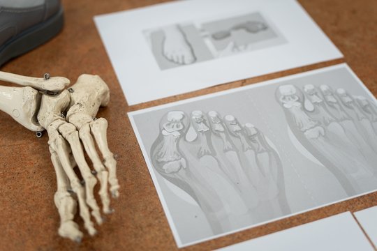 Specialistė paaiškino, kodėl kai kuriems itin sunku rasti patogius batus: neįvertina savo pėdos tipo