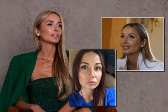 Monika Rachinštein nustebino išvaizdos pokyčiais: „Čia ne plastinė operacija“