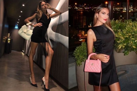 Garsų Italijos modelį mirtinai subadė buvęs mylimasis: moteris patyrė 24 durtines žaizdas