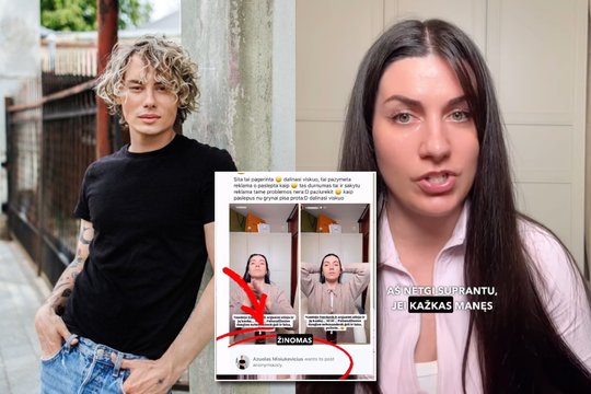 Žinoma plaukų ekspertė paviešino nederamą Ą. Misiukevičiaus poelgį: „Čia yra žemas lygis“