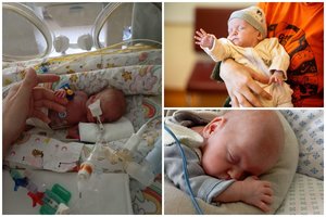 Klaudija gimusi svėrė vos 390 gramų ir tilpo į delną – Kauno medikai sukūrė neeilinį stebuklą