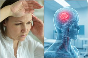 Išmokite kaip maldą: simptomai, kurie išduoda smegenų vėžį