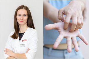 Šeimos gydytoja: rankų tirpimas ir nuovargis – ženklai, kad trūksta svarbaus vitamino