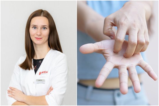 Šeimos gydytoja: rankų tirpimas ir nuovargis – ženklai, kad trūksta svarbaus vitamino