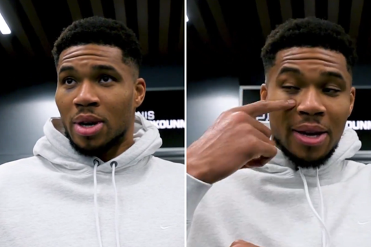 Po G. Antetokounmpo akimi – mėlynė: atskleidė netikėtą jos atsiradimo priežastį