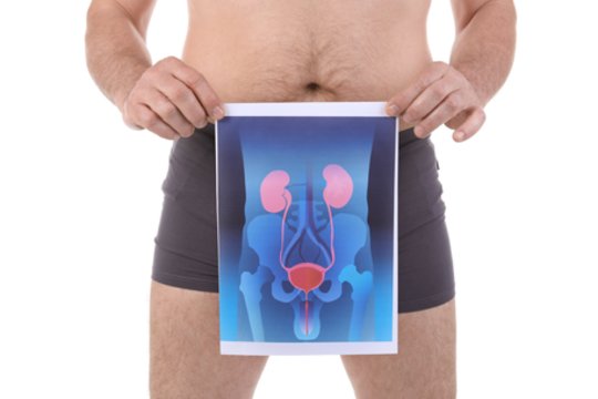 Kokie yra prostatos vėžio simptomai, dažnai sumaišomi su kitomis ligomis