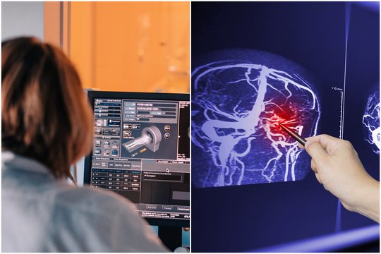 Gali išgelbėti gyvybę: profesorius pasakė, kaip atpažinti insultą