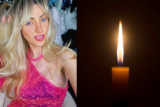 Paslaptingomis aplinkybėmis mirė 31-erių influencerė, norėjusi būti panaši į „Barbę“