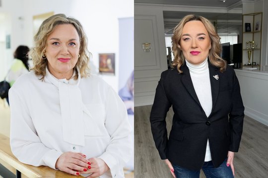 Rosita Čivilytė prasitarė apie nepagydomos ligos diagnozę: „Jaučiu, kad ji progresuoja“