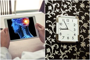 Gydytojai nustatė paros laiką, kai įvyksta daugiau nei pusė insultų