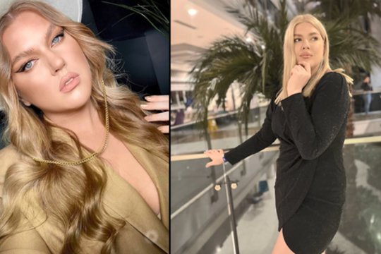 Gretos svajonę tapti modeliu sužlugdė sunki liga: „Buvo tiek blogai, kad aš, atrodo, merdėjau“