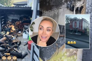 Gerdos Žemaitės namų kieme kilo gaisras: užsidegė sūkurinė vonia, parodė padarinius