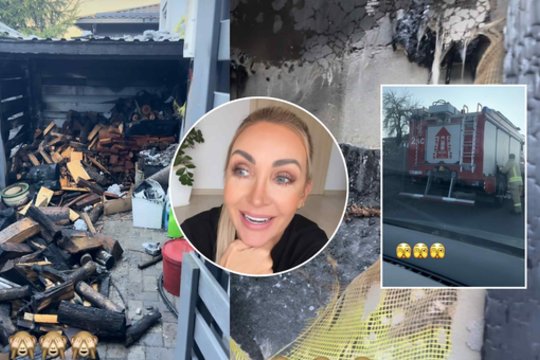 Gerdos Žemaitės namų kieme kilo gaisras: užsidegė sūkurinė vonia, parodė padarinius