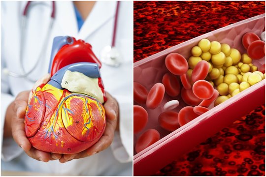 Dietologė patarė 1 produktą, kuris veikia kaip cholesterolio priešnuodis: jūsų širdis padėkos