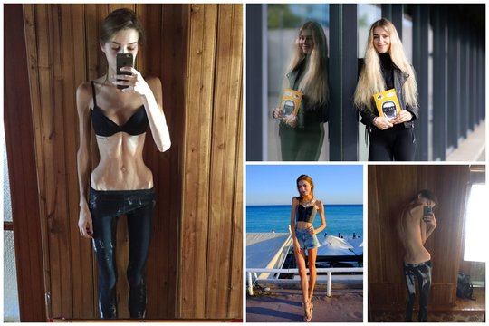 Mirčiai į akis žiūrėjusi manekenė Paula Čepinskaitė ryžosi išpažinčiai: tai lyg alkanos ir stiprios pabaisos