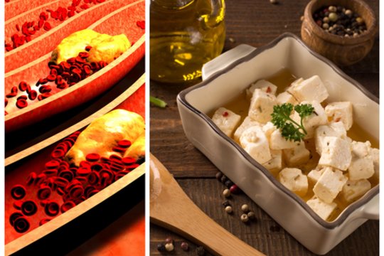 Sveika širdis be vaistų: 12 produktų, mažinančių „blogąjį“ cholesterolį