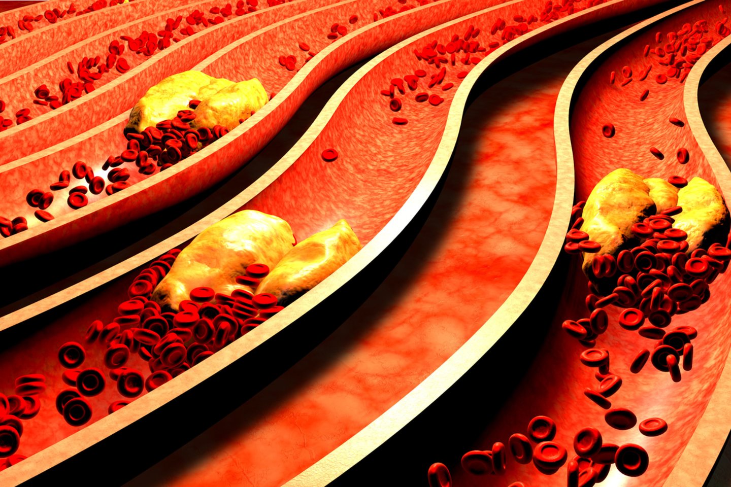 Sveika širdis be vaistų: 12 produktų, mažinančių „blogąjį“ cholesterolį.<br> 123rf.com asociatyvioji nuotr.