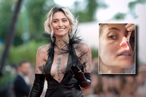 M. Jacksono dukra pirmą kartą parodė skaudžius narkotikų padarinius: vaizdas šokiruoja