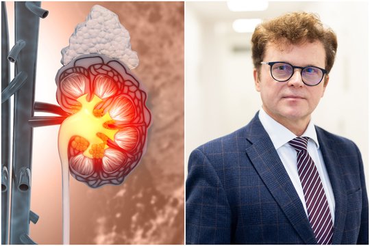 Profesorius R. Stukas paatviravo, kad nevalgo lietuvių pamėgtos daržovės: įspėjo – skatina inkstų ligą