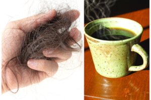 Šis daugelio mėgstamas gėrimas sukelia rimtų sveikatos bėdų – pradeda ne tik slinkti plaukai