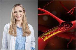 Chirurgė prašo suklusti – tai pirmieji kraujagyslių pažeidimo ženklai