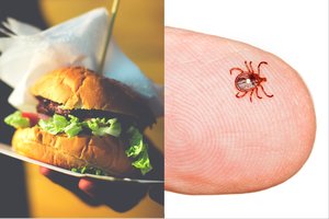 Pirmas toks atvejis istorijoje: mirtį sukėlė mėsainis ir įsisiurbusi erkė