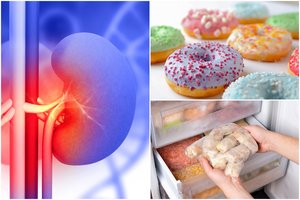 Nuodas ant pietų stalo: šis maistas kenkia visam žmogaus organizmui