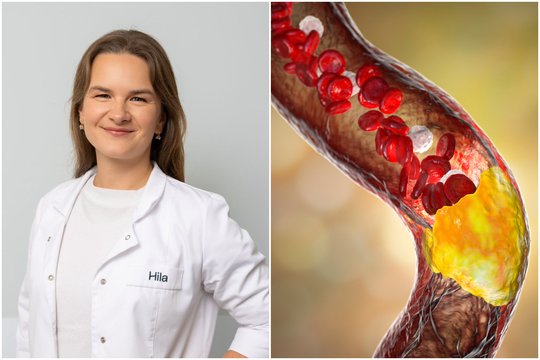 Gydytoja įvardijo, kas mažina „blogo“ cholesterolio kiekį: organizmas pats to pasigaminti negali