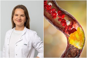 Gydytoja įvardijo, kas mažina „blogo“ cholesterolio kiekį: organizmas pats to pasigaminti negali