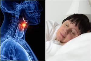 Nenorite susirgti stemplės vėžiu? Ištyrė, kiek valandų reikia miegoti kasnakt