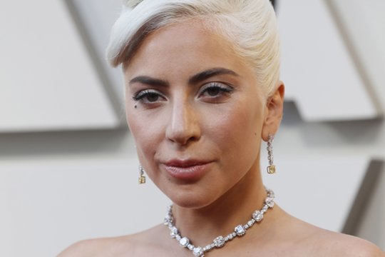 Lady Gaga gerbėjus pribloškė neeiliniais išvaizdos pokyčiais