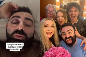 Filmo „Beprotiškos vestuvės“ žvaigždė patyrė rimtą galvos traumą: nelaimė įvyko per spektaklį