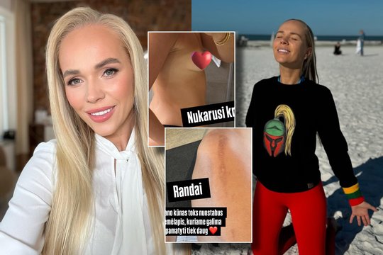 Ieva Voveris ryžosi apsinuoginti ir parodyti kūno pokyčius: „Ilgą laiką slėpiau“