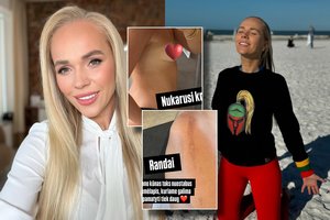 Ieva Voveris ryžosi apsinuoginti ir parodyti kūno pokyčius: „Ilgą laiką slėpiau“