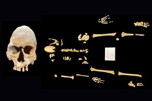 Viduramžių riteris turėjo sunkią genetinę mutaciją