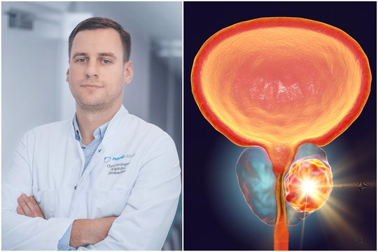 Lietuvių gyvybes šienauja ligos žemiau juosmens: griebia ir seną, ir jauną – gydytojas prašo suklusti